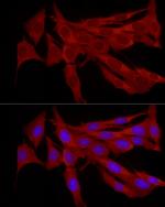 TRIM21 Antibody in Immunocytochemistry (ICC/IF)