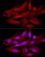 TRIM21 Antibody in Immunocytochemistry (ICC/IF)