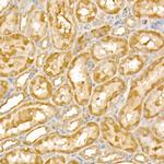 TRIM21 Antibody in Immunohistochemistry (Paraffin) (IHC (P))