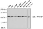 Alix Antibody in Western Blot (WB)