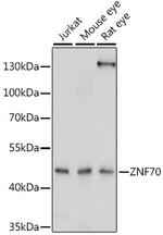 ZNF70 Antibody in Western Blot (WB)