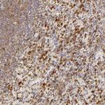 APOBEC3G Antibody in Immunohistochemistry (Paraffin) (IHC (P))