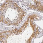 APOBEC3G Antibody in Immunohistochemistry (Paraffin) (IHC (P))