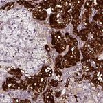 Dopamine beta Hydroxylase Antibody in Immunohistochemistry (Paraffin) (IHC (P))