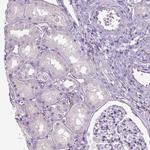 Dopamine beta Hydroxylase Antibody in Immunohistochemistry (Paraffin) (IHC (P))