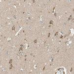 DKK3 Antibody in Immunohistochemistry (Paraffin) (IHC (P))