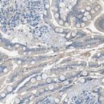 GPR77 Antibody in Immunohistochemistry (Paraffin) (IHC (P))