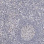 Dystrophin Antibody in Immunohistochemistry (Paraffin) (IHC (P))