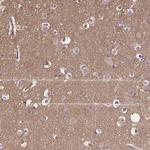 CRMP1 Antibody in Immunohistochemistry (Paraffin) (IHC (P))