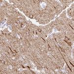 HEY1 Antibody in Immunohistochemistry (Paraffin) (IHC (P))