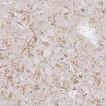 GluR3 Antibody in Immunohistochemistry (Paraffin) (IHC (P))