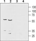 ENT1 Antibody in Western Blot (WB)