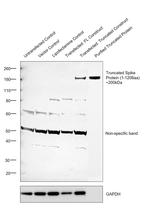 SARS/SARS-CoV-2 Spike Protein (S1/S2) Antibody in Western Blot (WB)