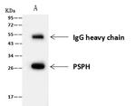 PSPH Antibody in Immunoprecipitation (IP)