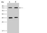 PAPSS1 Antibody in Western Blot (WB)