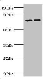 ALOX15B Antibody in Western Blot (WB)