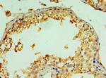 Cathepsin V Antibody in Immunohistochemistry (Paraffin) (IHC (P))