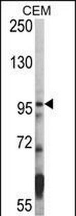 HDAC7 Antibody in Western Blot (WB)