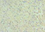 GluD2 Antibody in Immunohistochemistry (Paraffin) (IHC (P))