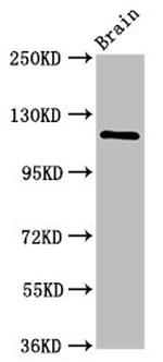 HIP1R Antibody in Western Blot (WB)