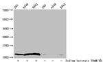 2-hydroxyisobutyryl-Histone H4 (Lys8) Antibody in Western Blot (WB)