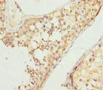 NCALD Antibody in Immunohistochemistry (Paraffin) (IHC (P))