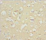 NCALD Antibody in Immunohistochemistry (Paraffin) (IHC (P))