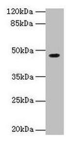 NXF5 Antibody in Western Blot (WB)