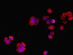 RCBTB2 Antibody in Immunocytochemistry (ICC/IF)