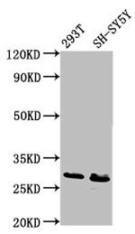 RFXANK Antibody in Western Blot (WB)