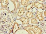 RHD Antibody in Immunohistochemistry (Paraffin) (IHC (P))