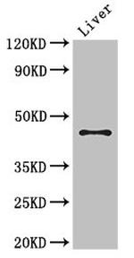 RHD Antibody in Western Blot (WB)