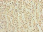 TCTA Antibody in Immunohistochemistry (Paraffin) (IHC (P))