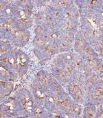 IFITM3 Antibody in Immunohistochemistry (Paraffin) (IHC (P))