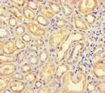 B4GALT5 Antibody in Immunohistochemistry (Paraffin) (IHC (P))