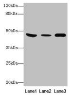 B4GALT5 Antibody in Western Blot (WB)