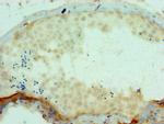 SSX2 Antibody in Immunohistochemistry (Paraffin) (IHC (P))