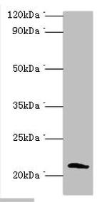 SSX2 Antibody in Western Blot (WB)