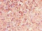 PHLDB2 Antibody in Immunohistochemistry (Paraffin) (IHC (P))