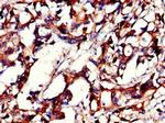 PHLDB2 Antibody in Immunohistochemistry (Paraffin) (IHC (P))