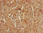 SULF2 Antibody in Immunohistochemistry (Paraffin) (IHC (P))