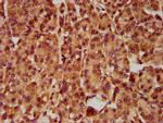 SLC5A5 Antibody in Immunohistochemistry (Paraffin) (IHC (P))