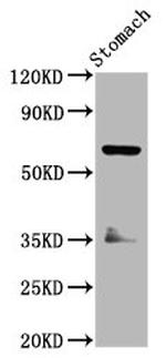 SLC5A5 Antibody in Western Blot (WB)