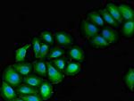 VPS39 Antibody in Immunocytochemistry (ICC/IF)