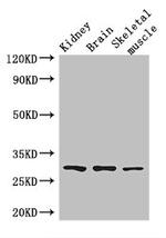 PLD6 Antibody in Western Blot (WB)