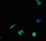 PNPLA1 Antibody in Immunocytochemistry (ICC/IF)