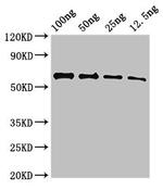 UNC80 Antibody in Western Blot (WB)