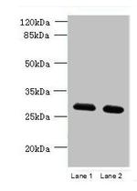 TMEM38B Antibody in Western Blot (WB)
