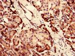 SI-CLP Antibody in Immunohistochemistry (Paraffin) (IHC (P))