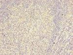 RTDR1 Antibody in Immunohistochemistry (Paraffin) (IHC (P))